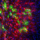 Image for article titled When (Microscopic) Blood Vessels Explode